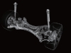 refined-suspension-nissan-d-platform